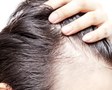 Исследователи нашли гены, вызывающие выпадение волос у мужчин